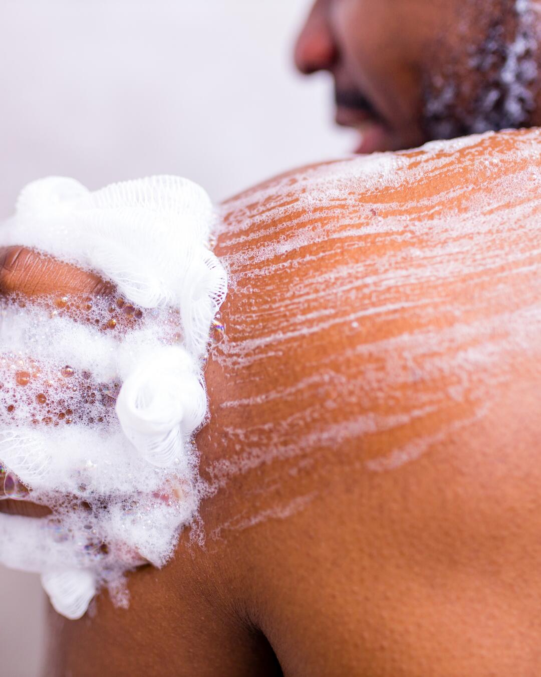 Acne on the buttocks caused by moisture